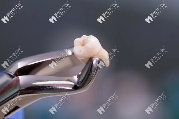 高血壓拔牙有什么風(fēng)險