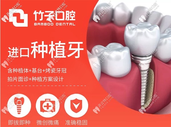 進口種植牙8120元起