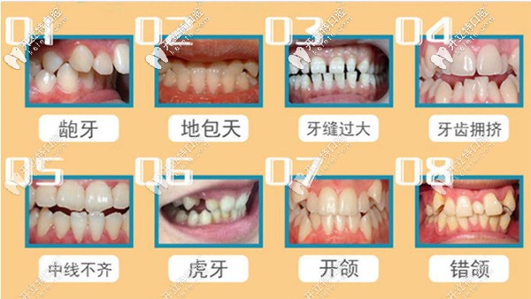 昆明美奧做矯正牙齒怎么樣