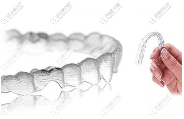 無(wú)托槽隱形牙套