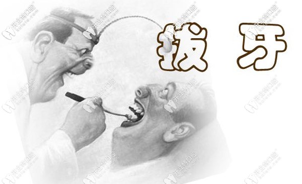 棗莊拔牙價格一覽表