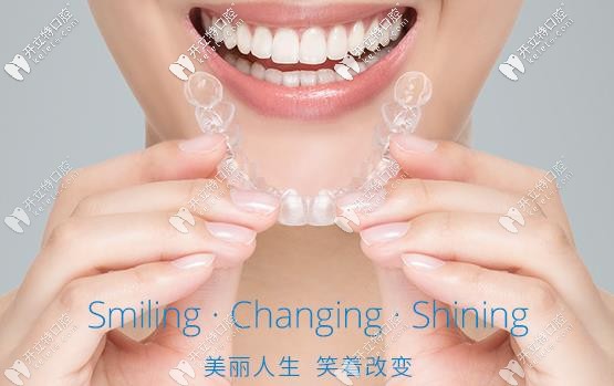 時(shí)代天使牙套