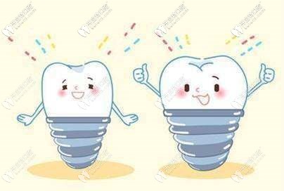 合肥各口腔醫(yī)院做種植牙多少錢一顆？真實(shí)收費(fèi)標(biāo)準(zhǔn)揭曉！