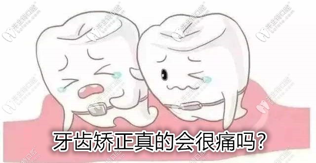 你知道矯正牙齒的痛算幾級(jí)疼痛嗎?來看看整牙哪步較疼吧！