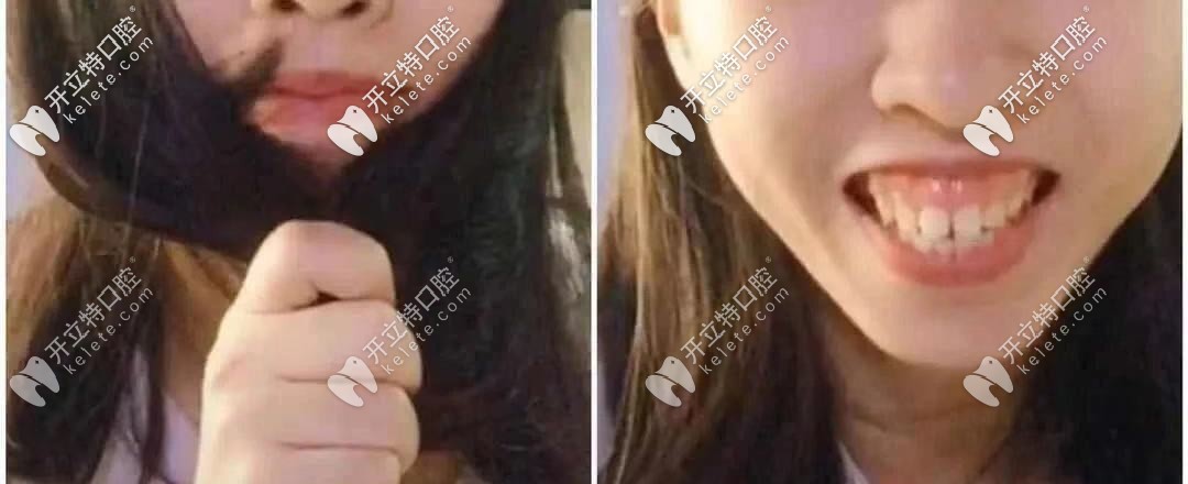 顏值是否也被封印？