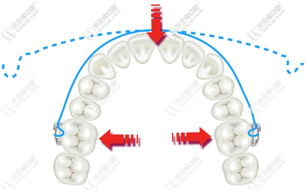 這份口腔正畸弓絲的種類及性能還挺全面嘛！