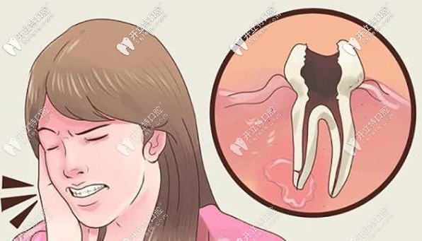 補(bǔ)牙洞疼不疼?超詳細(xì)的補(bǔ)牙過(guò)程來(lái)了解下