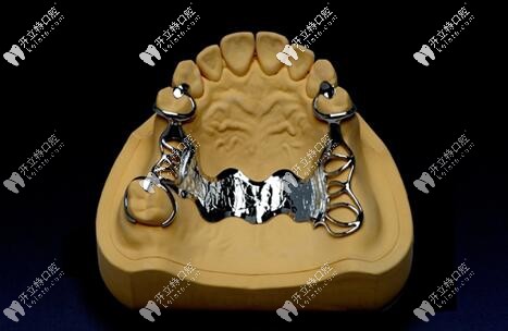 德國(guó)bego鈷鉻支架