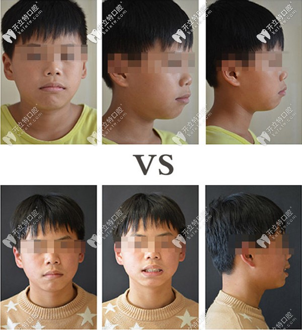 昆明牙科醫(yī)院哪家好且價(jià)格便宜?昆明10家平價(jià)口腔含柏德