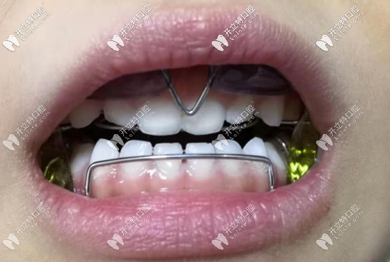 龐瑀醫(yī)生的擅長項(xiàng)目