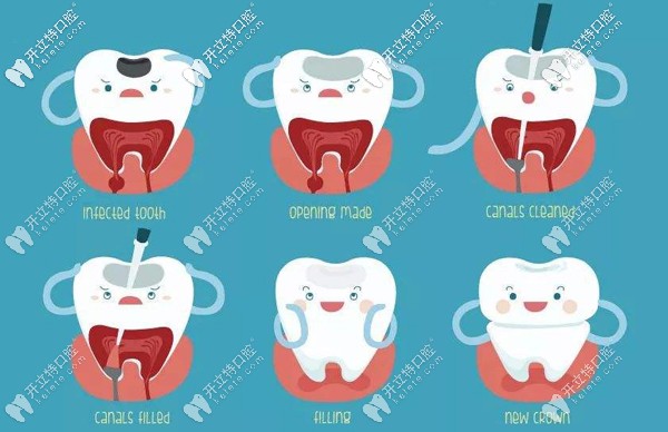 聽說牙疼會引起發(fā)燒,那牙痛發(fā)燒該如何處理呢？