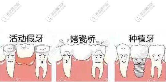 缺牙不種的后果