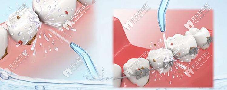 半年洗一次牙，保持牙齒健康