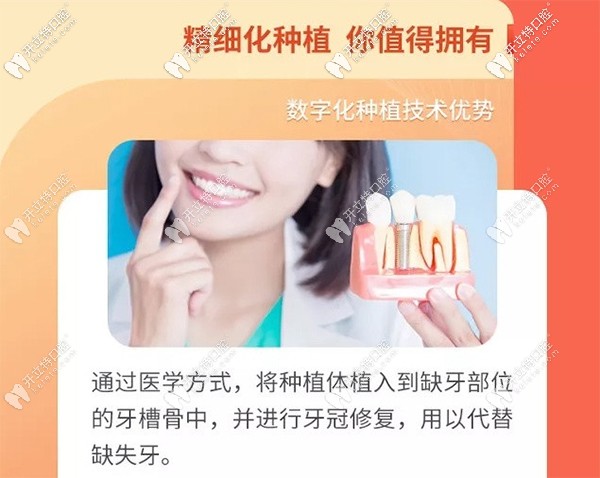 昆明竹子口腔做瑞典Astra即刻種植牙怎么樣？真實(shí)評(píng)價(jià)來(lái)襲