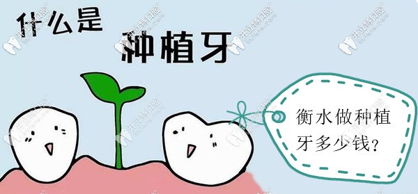 衡水種植牙價(jià)格是多少錢
