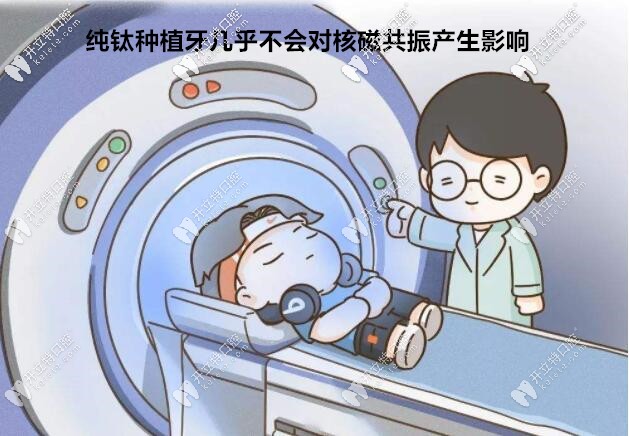 種植牙幾乎不會對核磁共振產(chǎn)生影響