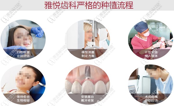 嚴(yán)格的種植牙流程