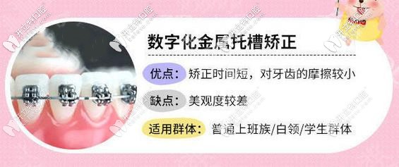 數(shù)字化金屬矯正器優(yōu)缺點(diǎn)分享
