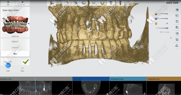 時代天使數(shù)字化矯正系統(tǒng)