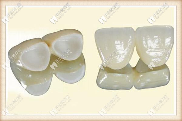 1000元的全瓷牙和1500的質(zhì)量區(qū)別大嗎,是否價格越貴越好?