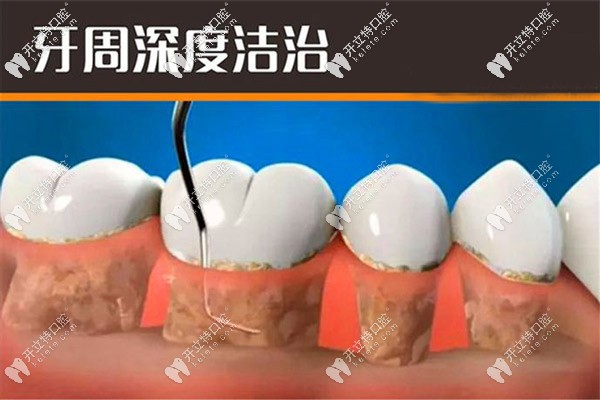 丹麥水冷激光患者評(píng)價(jià)