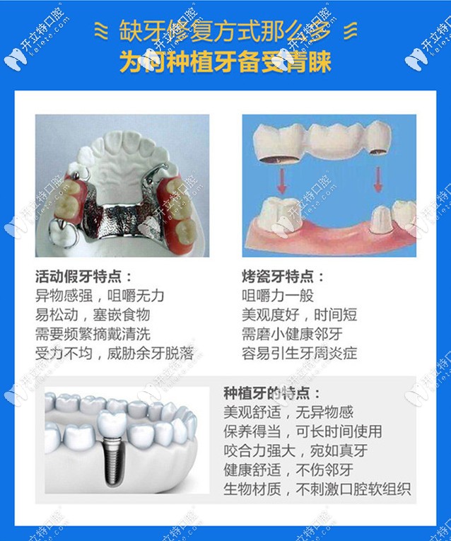 種植牙的優(yōu)勢(shì)