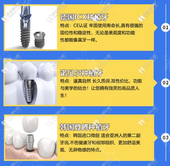 各品牌種植牙不同優(yōu)勢(shì)
