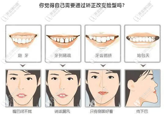 適應(yīng)癥狀牙齒問(wèn)題