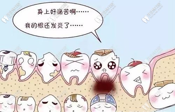 再和你聊聊發(fā)炎和干槽癥的區(qū)別？干槽癥前兆是啥樣？