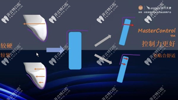 抗蠕變性強(qiáng)的材料，可以更加的控制牙齒