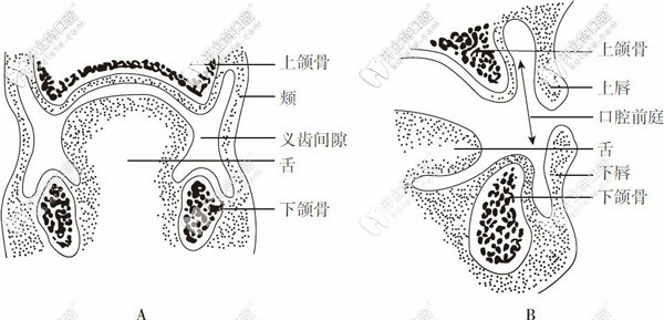 義齒間隙和義齒表面