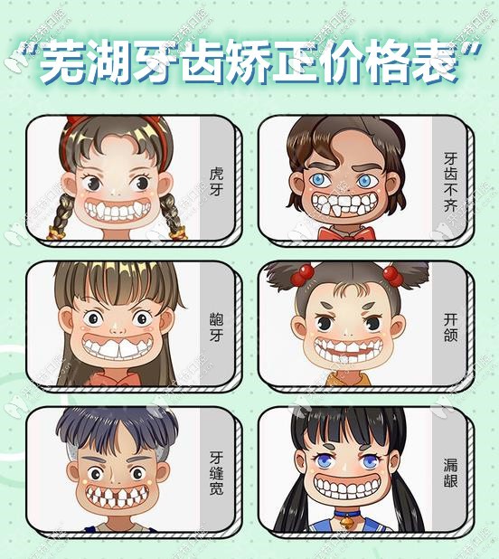 看完這“蕪湖牙齒矯正的價格表”后,終明白牙套貴的理由啦