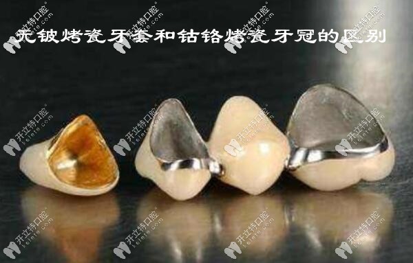 無鈹烤瓷牙和鈷鉻烤瓷牙冠的區(qū)別不止是價格,還有材質(zhì)哦!