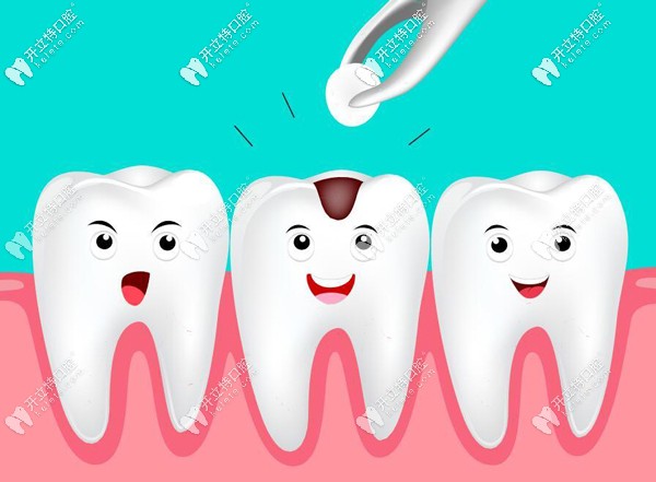 3m樹脂補(bǔ)牙一般多少錢