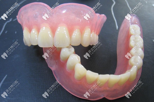 松風(fēng)塑鋼牙示意圖