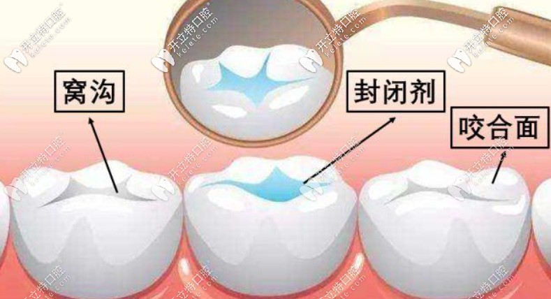 中瑞邁維口腔騙局謠言:10院連鎖+價(jià)格雙透明,老牌牙科4.7口碑