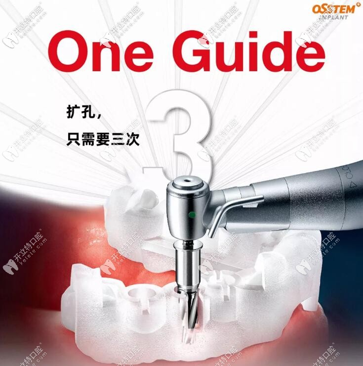 介紹:韓國奧齒泰IMPLANT種植牙數(shù)字化導板是干什么用的