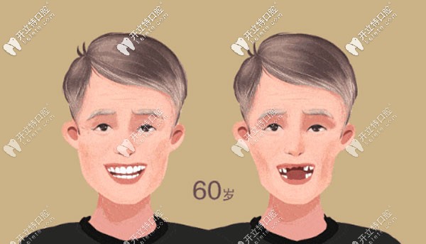 種植前后的效果對(duì)比圖