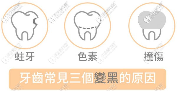 兒童牙齒黑斑是什么原因引起的，需要治療嗎？