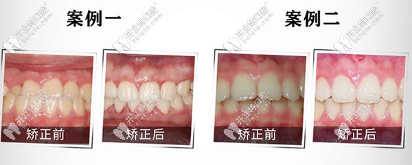 重慶團圓私立口腔醫(yī)院到底好不好？是連鎖牙科么？