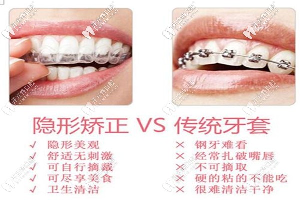 承德可米口腔牙齒矯正費(fèi)用