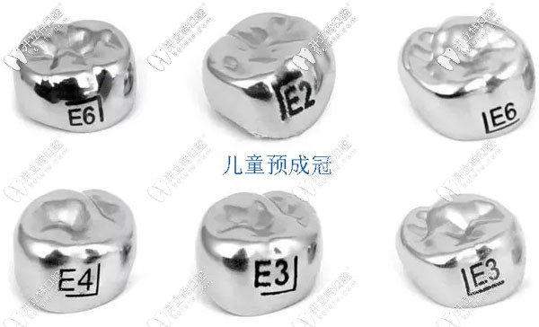 兒童預成冠示意圖