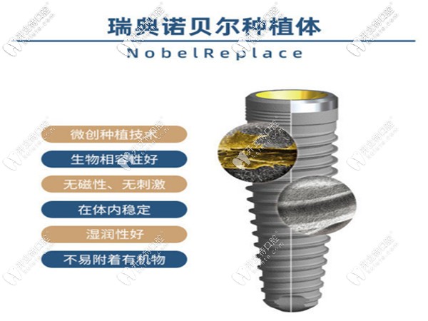 南京博韻瑞典諾貝爾種植體價格