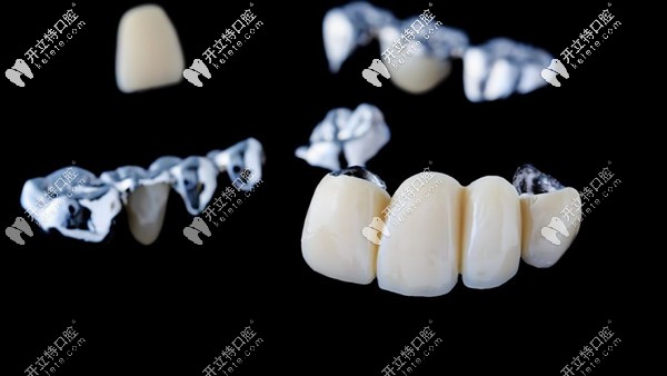 真相了,柳州市華心口腔做烤瓷和全瓷牙價(jià)格是這樣的?