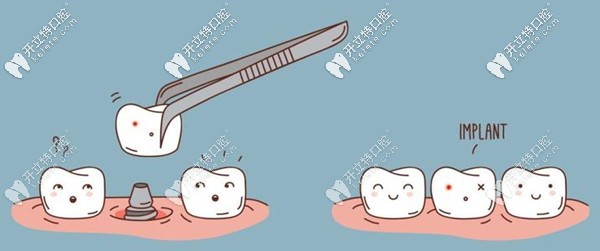 銀川和仁堂牙科醫(yī)院種植牙收費標(biāo)準(zhǔn)