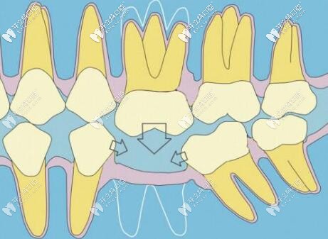 位于海港區(qū)的秦皇島藍(lán)天口腔價(jià)格無(wú)敵了,你覺(jué)得便宜嗎