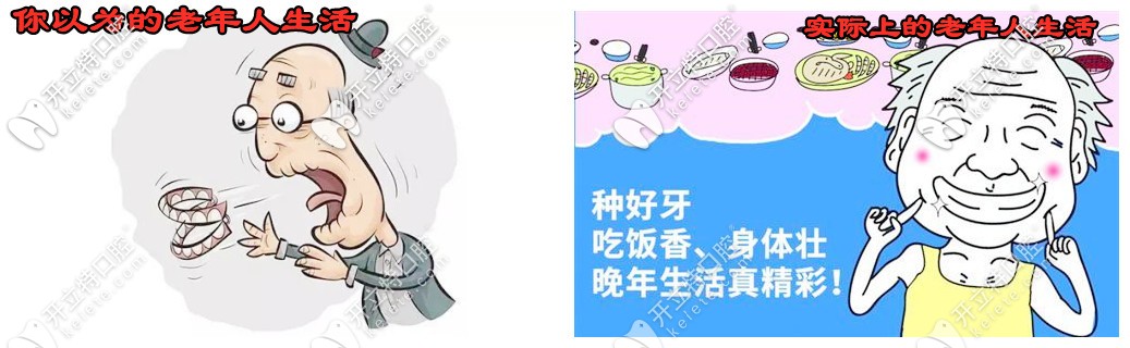 老人掉了很多牙怎么辦？看58歲楊女士的種牙體驗(yàn)