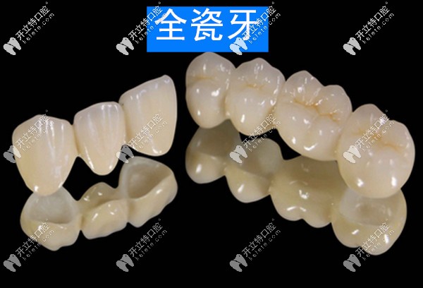 騰沖德博口腔全瓷牙的價(jià)格