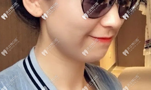 兩年的時間牙齒變化蠻大的