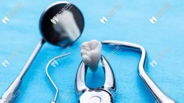 拔牙前的注意事項與禁忌癥,你有必要知道